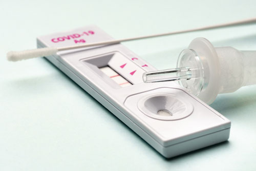 Cagliari, il Nas sequestra 8 mila test rapidi per il covid-19: il venditore non era autorizzato