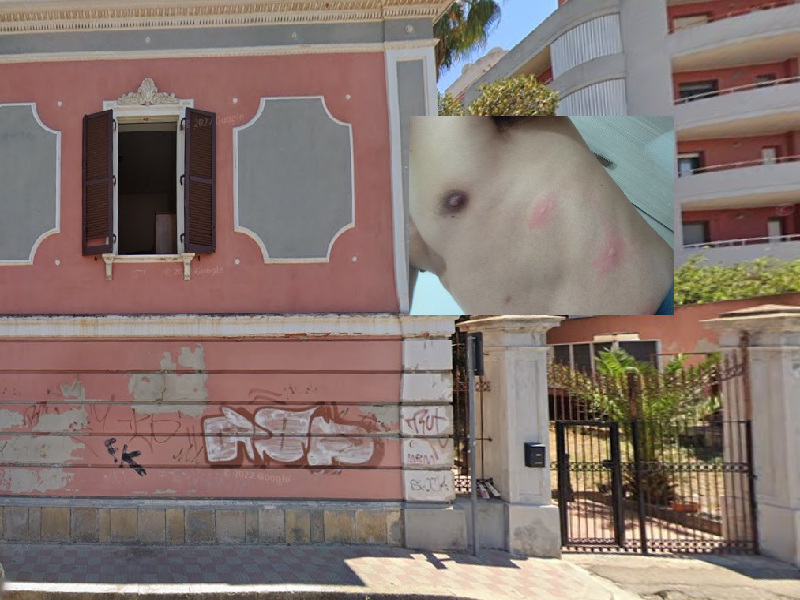 Cagliari, emergenza a Villa Asquer: “Cimici grandi come zecche che succhiano il sangue”