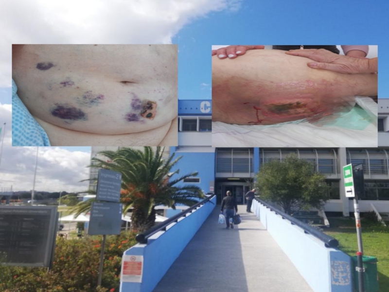 Policlinico di Monserrato, la denuncia: “Nostro padre con piaghe e in fin di vita dopo il ricovero, nudo e legato come un animale”