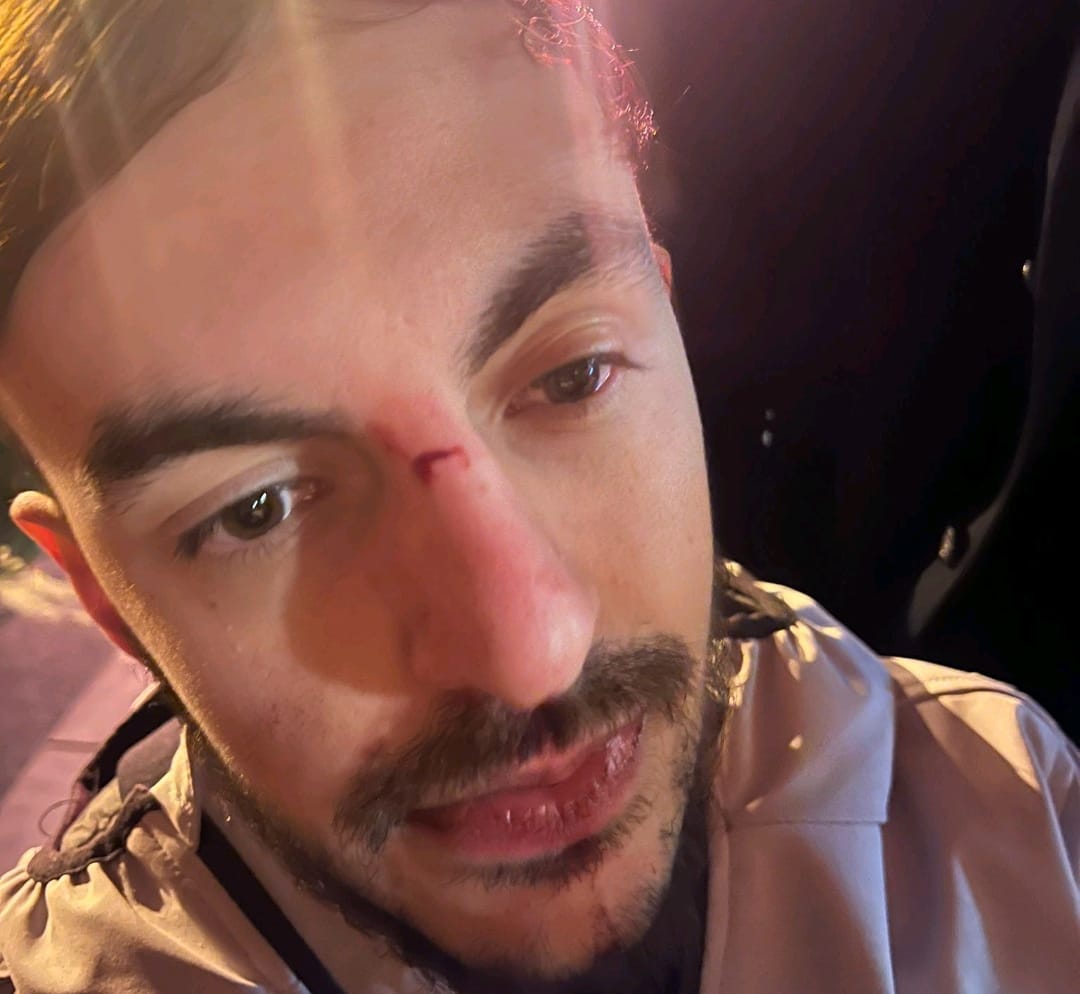 Cagliari, la denuncia: “Aggredito e preso a testate da un buttafuori”