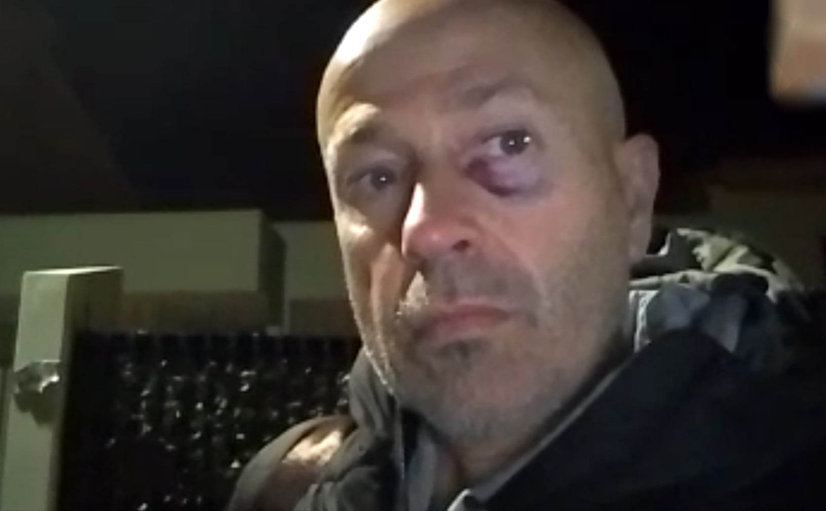 Cagliari, pugni in faccia da un 21enne per aver difeso i passeggeri: “Sui bus troppi ragazzini disgraziati”