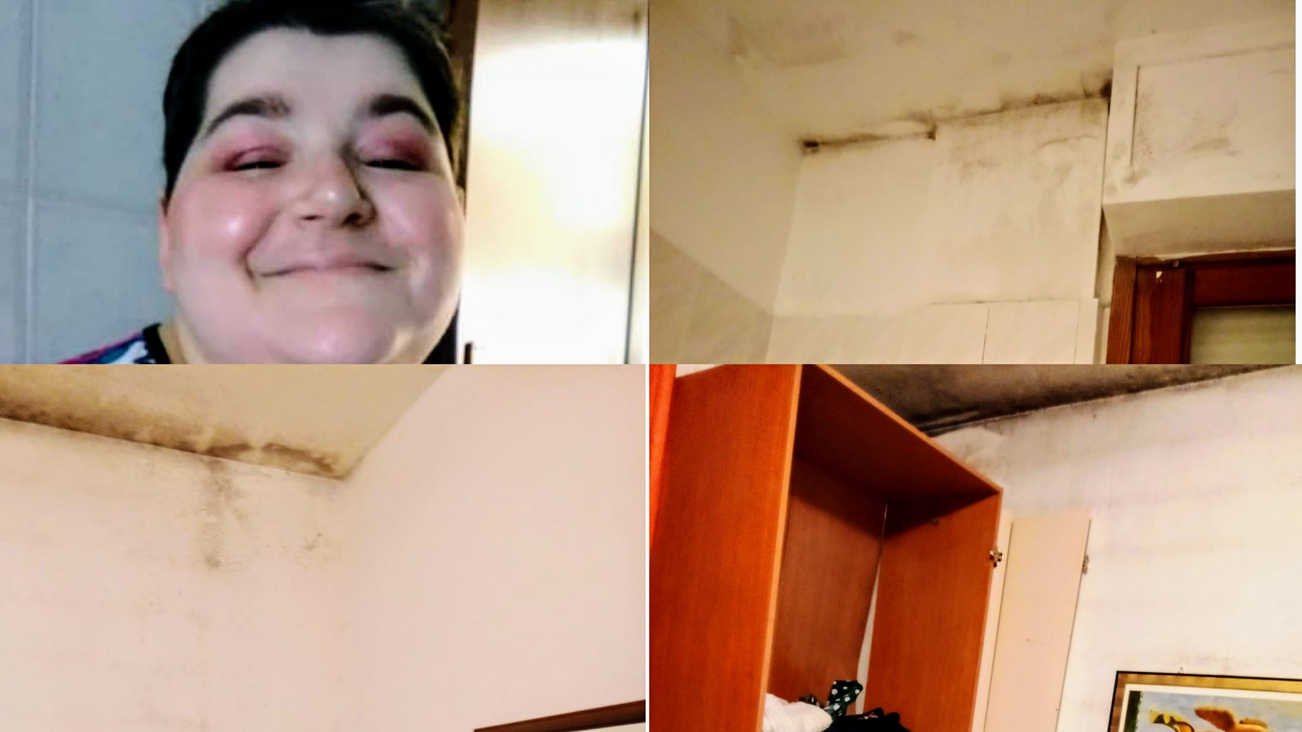 Capoterra, l’sos disperato di Alessandra Mazzi: “Disabile, vivo in una casa piena di muffa”