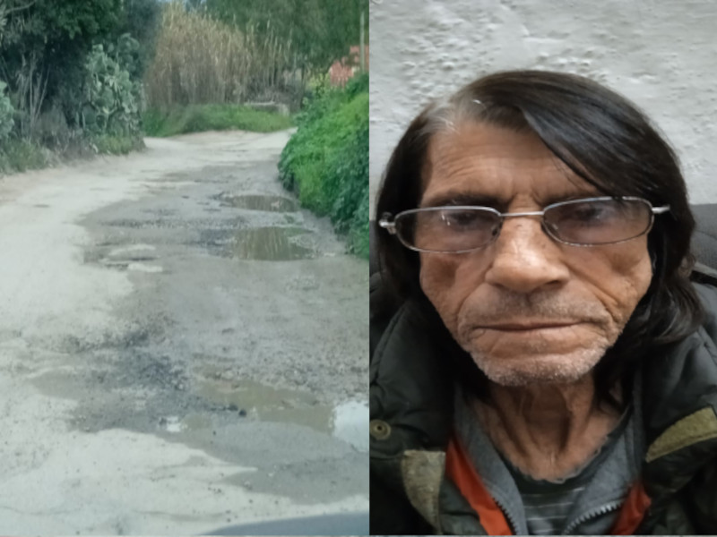 Si frattura due volte per colpa delle buche in via San Martino a Quartu: “Quando verrà asfaltata?”