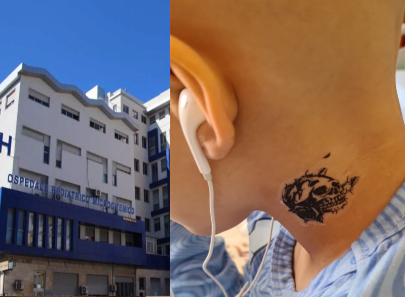 Cagliari, anestesisti esasperati nel Microcitemico allo sbando: “Due bimbi colpiti da uno choc anafilattico”