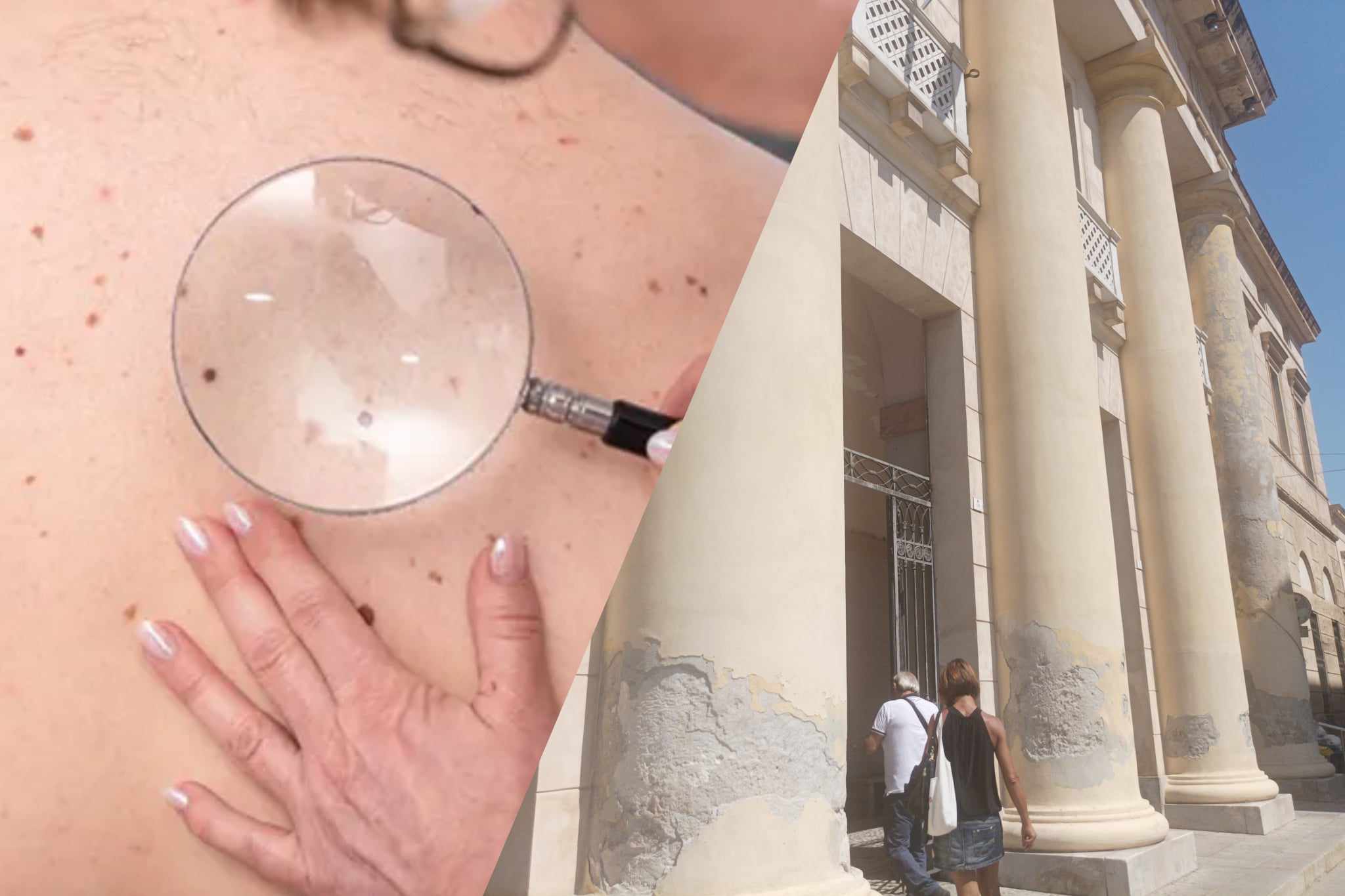 Dermatologia da incubo a Cagliari: una visita al San Giovanni di Dio? Attendi 4 mesi e incrocia le dita