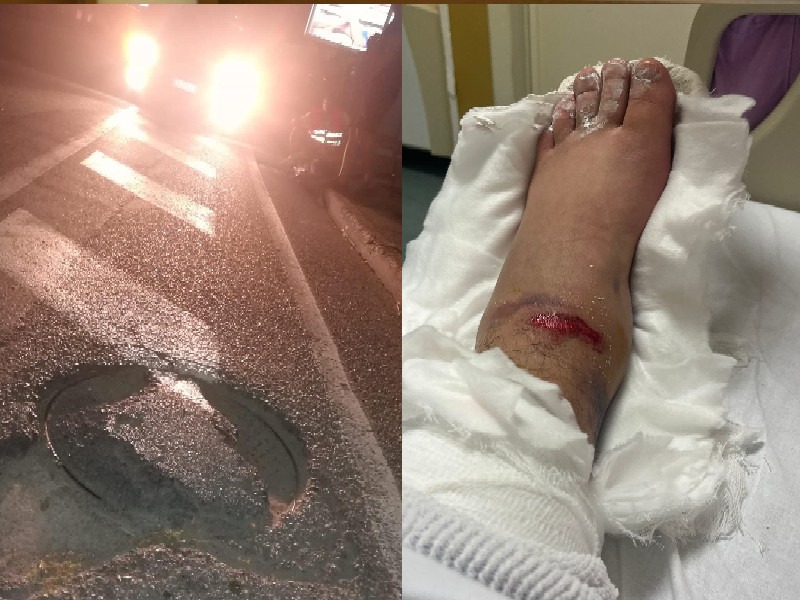 Cade in monopattino per colpa di un tombino in viale Monastir a Cagliari, 22enne fratturato al Ss. Trinità