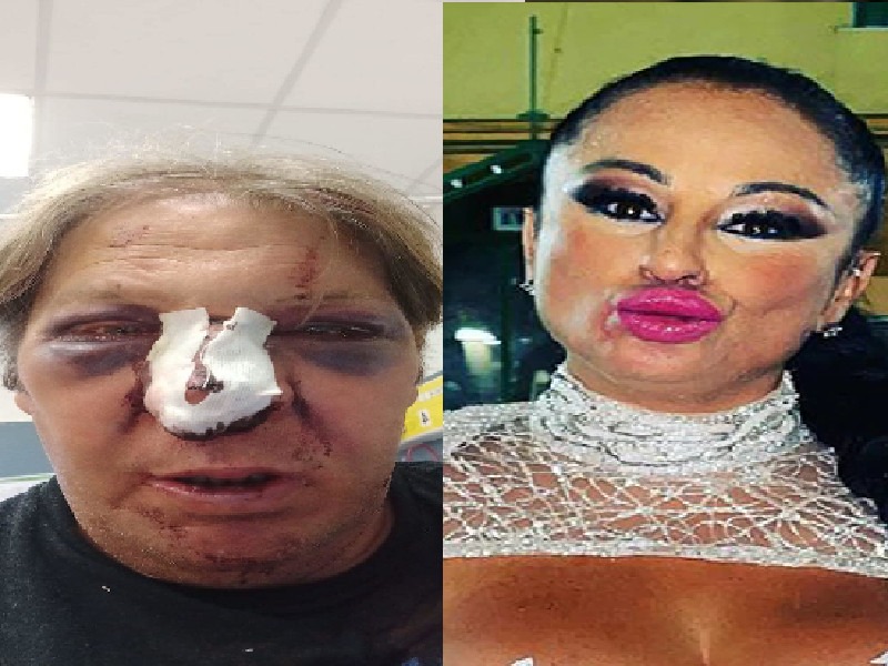 Cagliari, pestato dopo lo show di “Svergognata”: “tziu” Lai trovato privo di sensi in una pozza di sangue