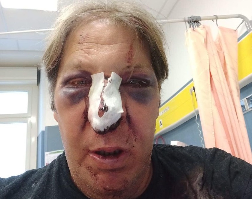 Antonello Lai ferito a Is Mirrionis, i titolari del Mamù: “Nessuna aggressione, è caduto da solo”