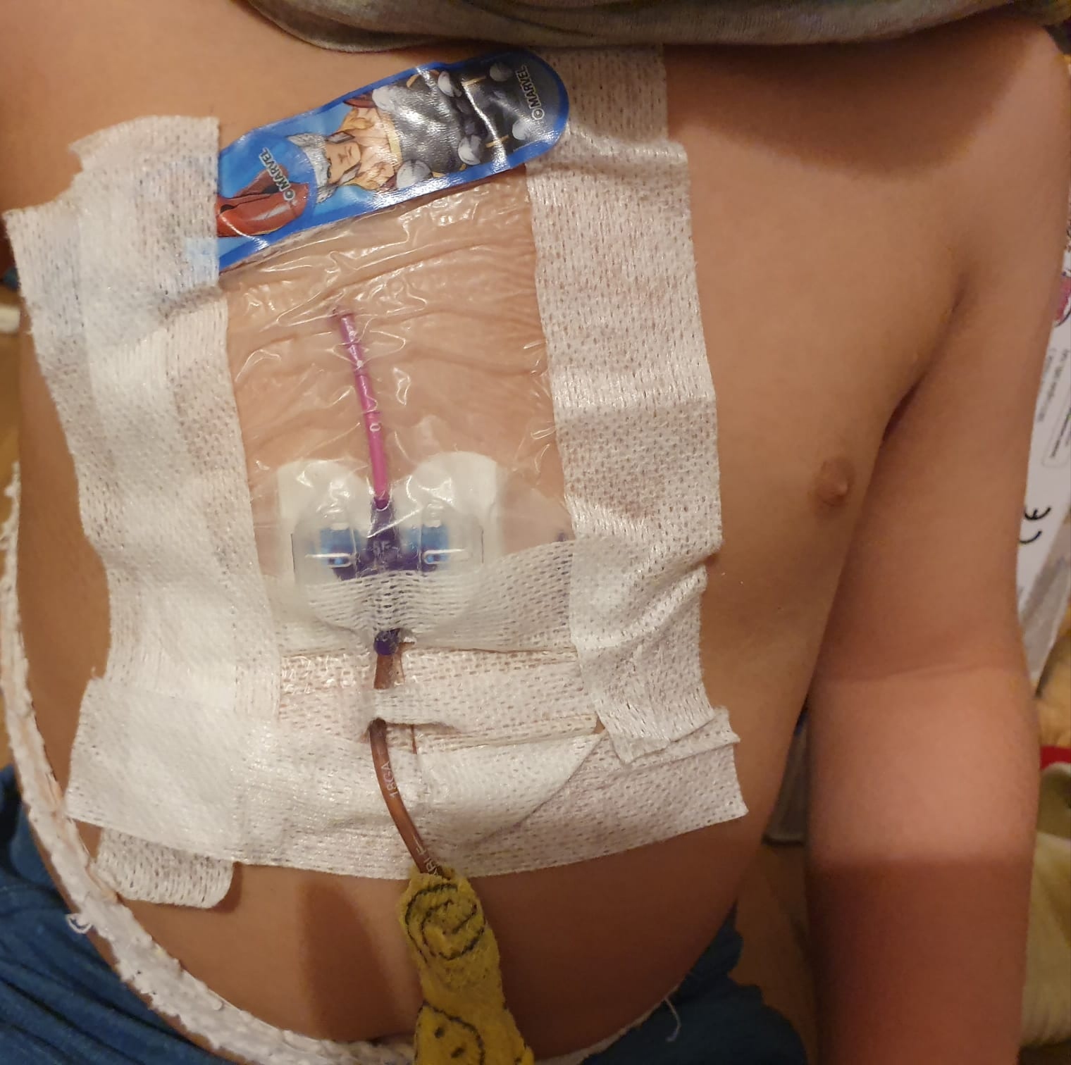 Cagliari, l’urlo di mamme e papà al Microcitemico: “Cinque bimbi aspettano da mesi la rimozione del catetere”