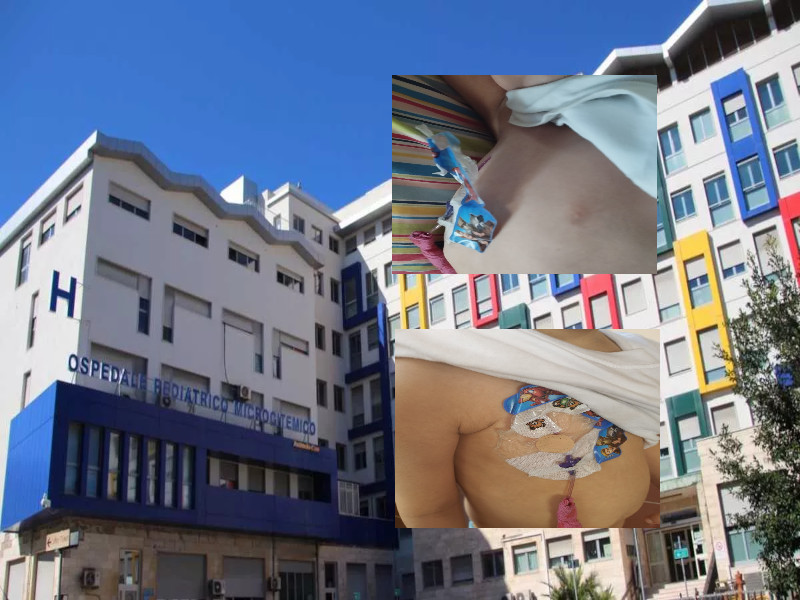 Cagliari, l’estate dolorosa dei bimbi del Microcitemico: “Cateteri non rimossi e viaggi estenuanti per le medicazioni”