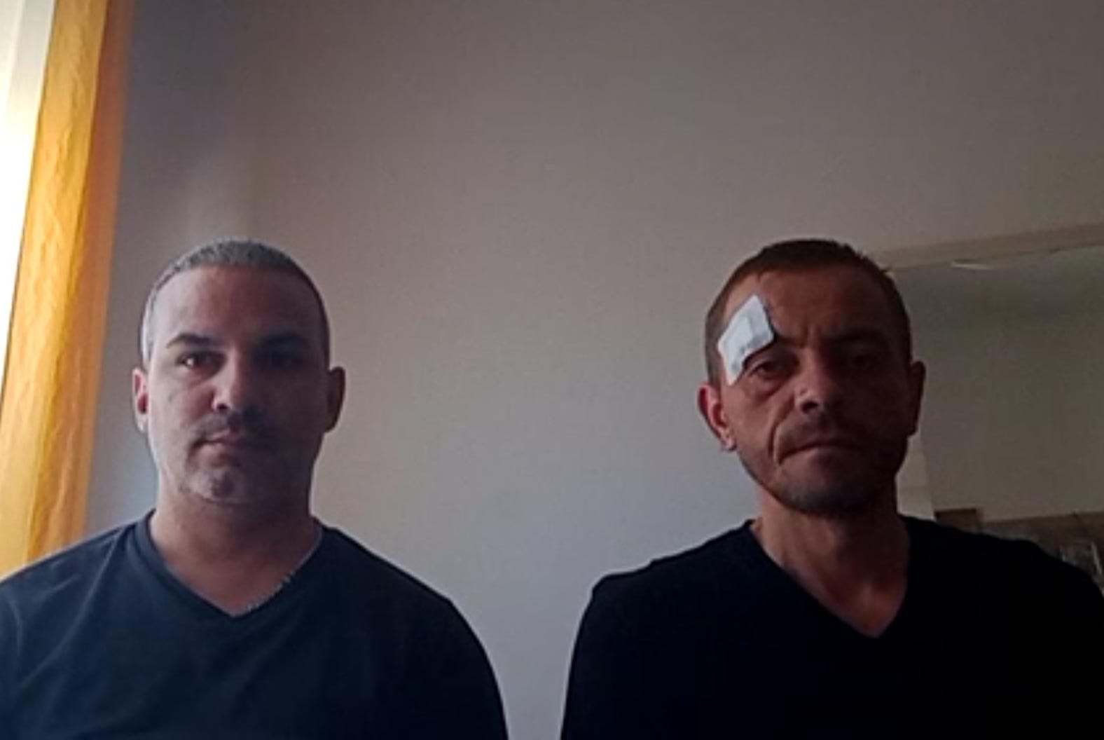 Cagliari, follia a Is Mirrionis: rubano il cane di un anziano malato e picchiano il suo badante