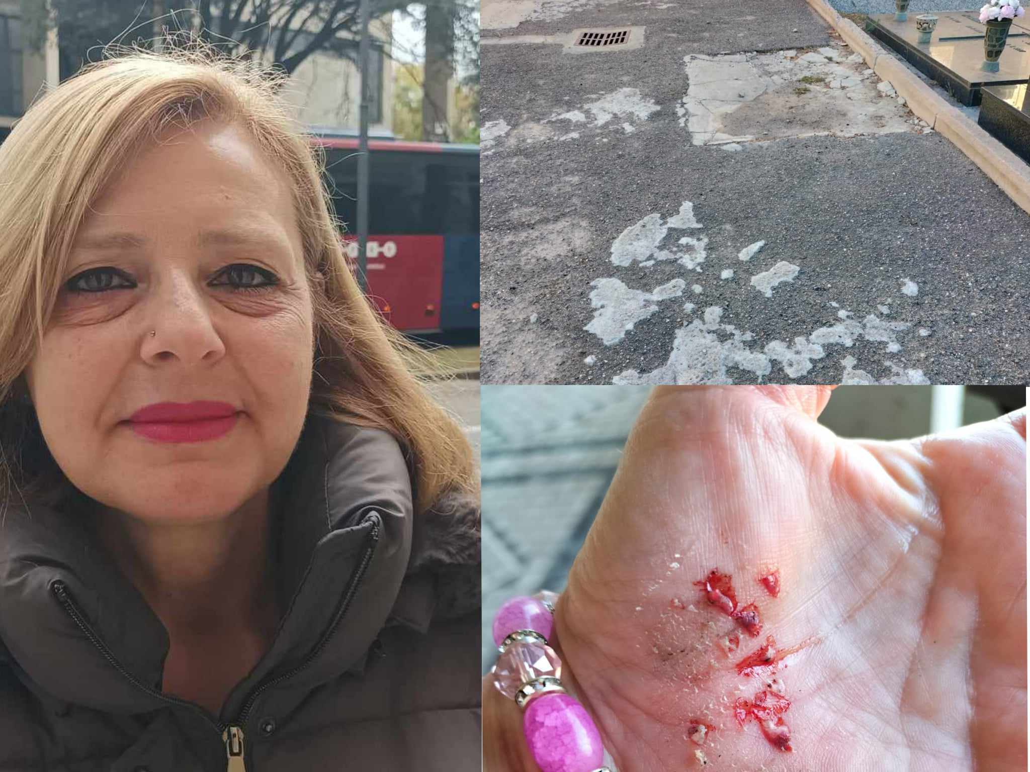 Pirri, cade al cimitero e si ferisce: “Dobbiamo fare lo slalom tra le buche”