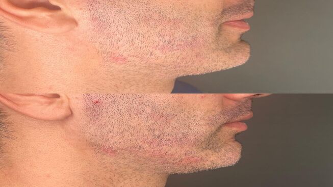 Approccio Maschile alla medicina estetica