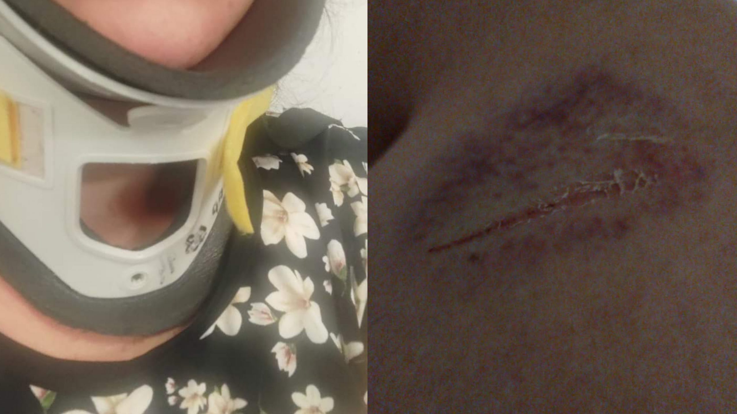 Infortunio sul bus Ctm, una donna perde la presa durante la ripartenza e sbatte violentemente il collo nel sedile