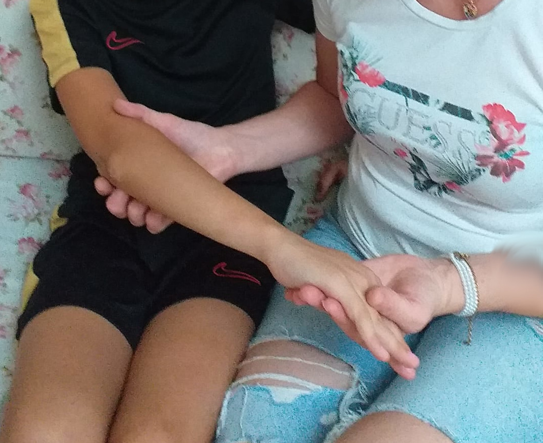 Si frattura un braccio, 12enne viene operato al Brotzu: “Dopo un anno non gli hanno ancora tolto i chiodi”