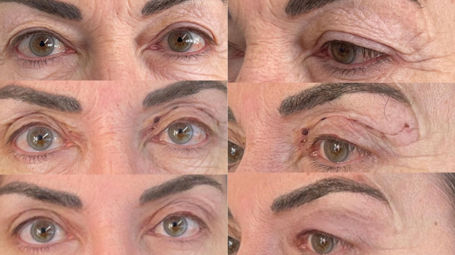 Contorno occhi: l’importanza di uno sguardo riposato