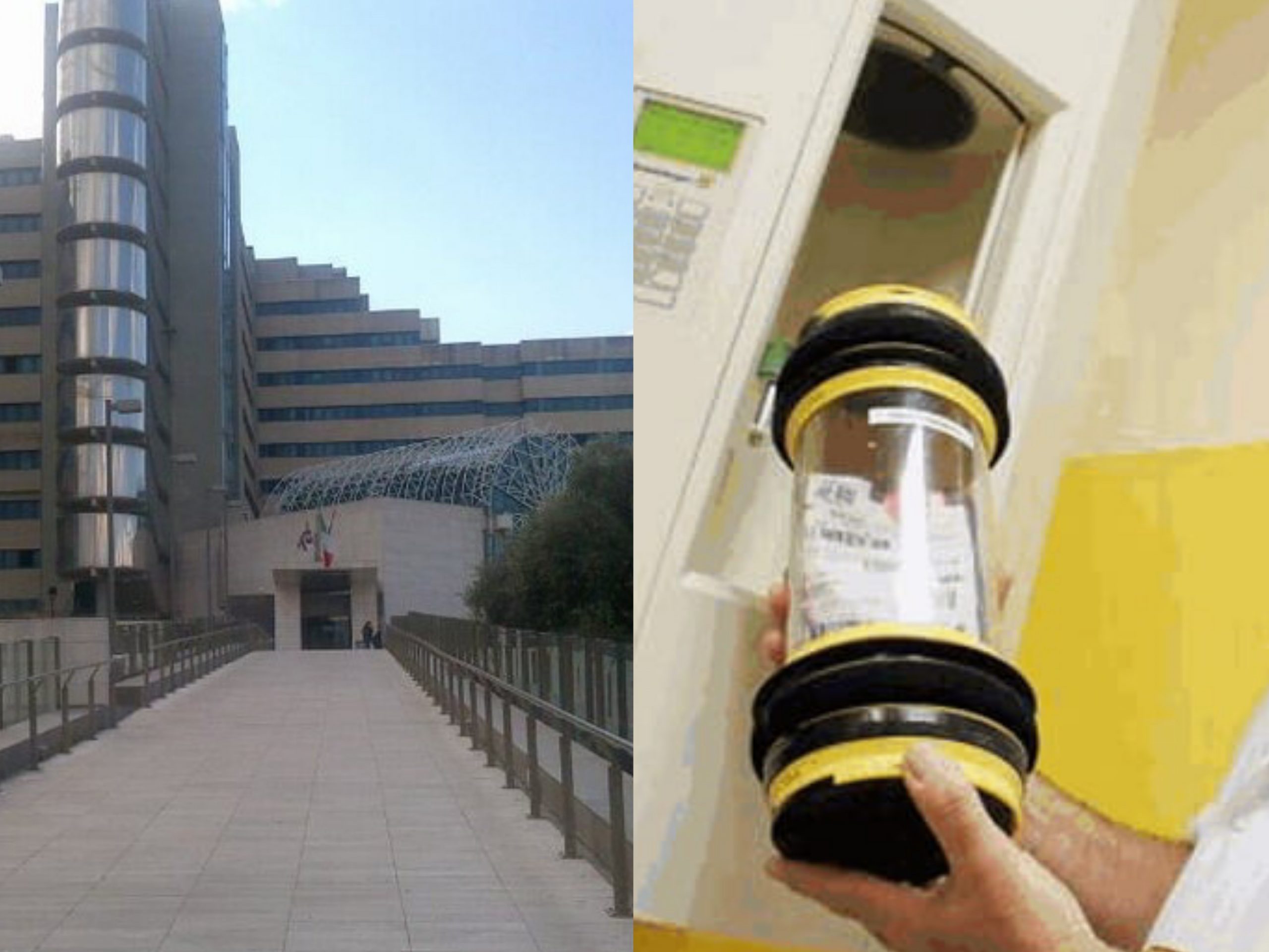 Cagliari, l’ultima beffa al Brotzu: “Oss costretti a ritirare le sacche di sangue a mano”