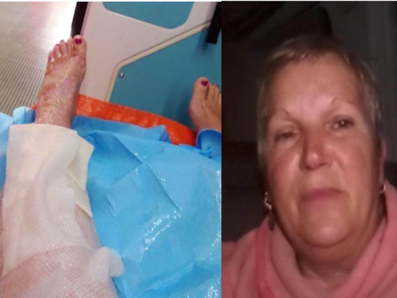Si ustiona con l’acqua bollente, dimessa dall’ospedale di San Gavino: “Dovrò pagarmi l’ambulanza per Sassari”