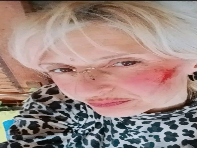 Quartu, la padrona dei cento cani: “Aggredita e colpita con una pietra mentre sfamavo i miei animali”