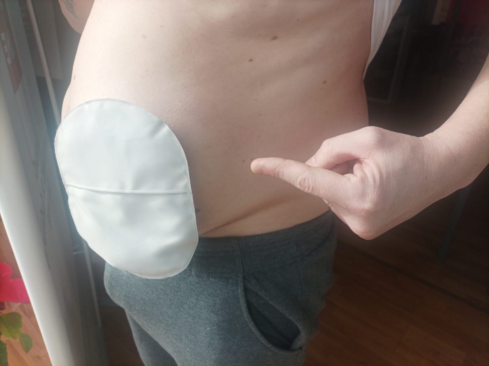 Stomizzato dolorante di Cagliari attende l’operazione da agosto: “Solo così posso tornare libero e lavorare bene”