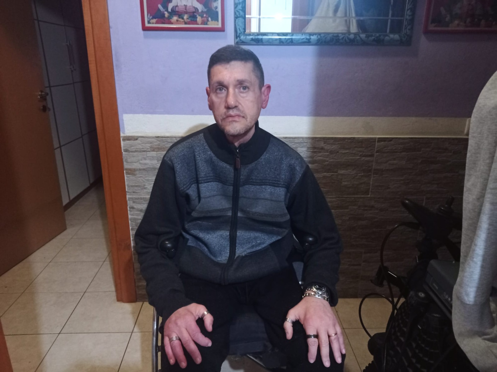 Senza soldi per l’auto, impossibile raggiungere l’ospedale a Cagliari: “La distrofia muscolare mi sta distruggendo”