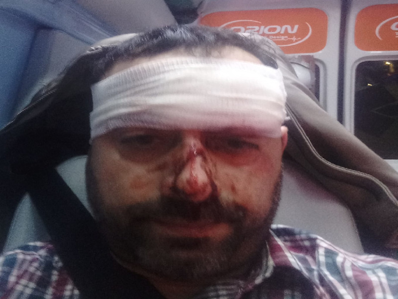 Cagliari, violenza in pieno centro: “Aggredito da 3 sconosciuti e preso a calci in faccia”