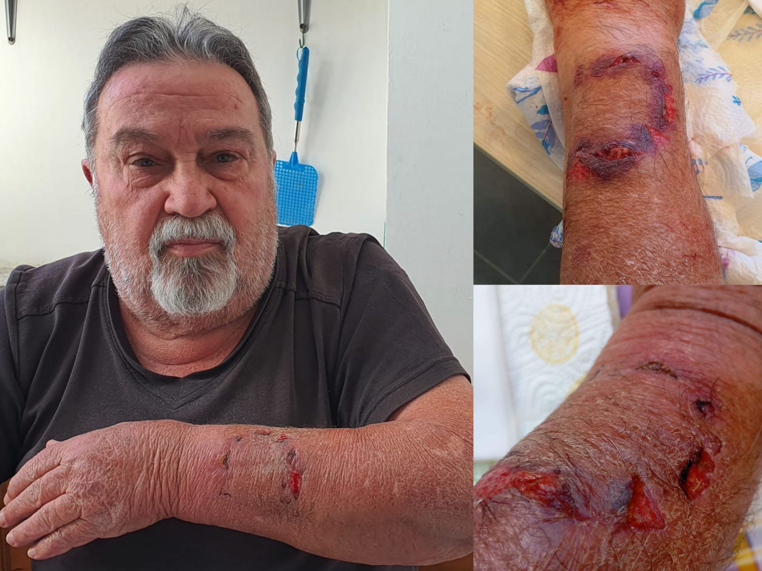 Cagliari, follia a Pirri: “Azzannato dal cane di un senzatetto, ferito al braccio e senza risarcimento”