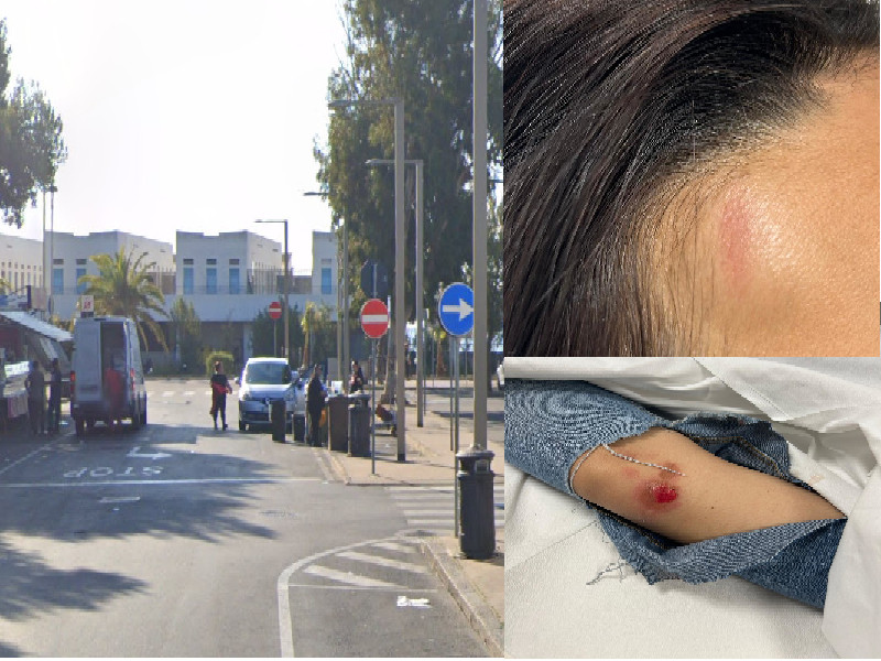 Cagliari, 16enne di Quartu pestata al Poetto: “Calci e pugni da due bulle per un ragazzino conteso”