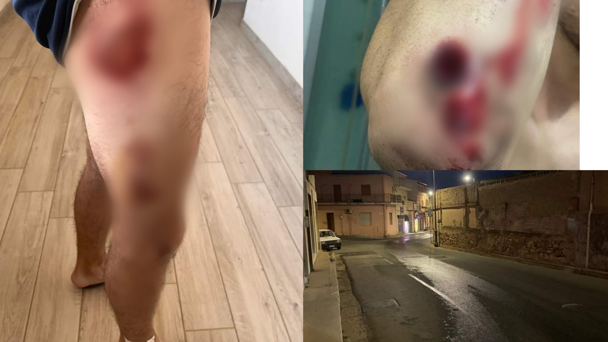 Capoterra, scivola con lo scooter a terra a causa di una perdita idrica