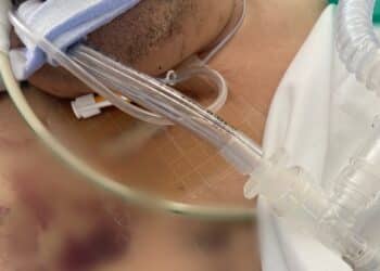 Lo sfogo di Arianna: “Mio fratello, aggredito in una colonia penale della Sardegna e lasciato senza assistenza”