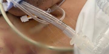 Lo sfogo di Arianna: “Mio fratello, aggredito in una colonia penale della Sardegna e lasciato senza assistenza”