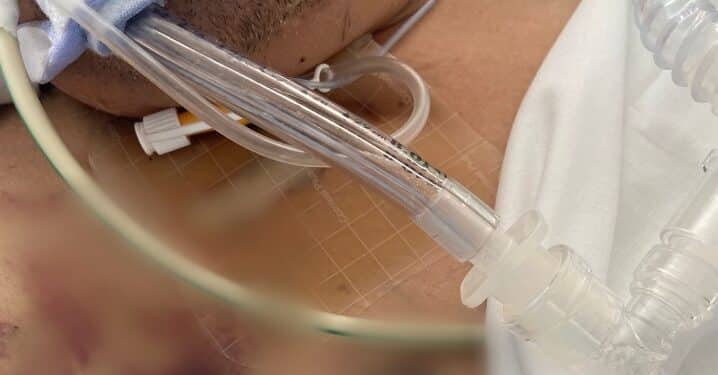 Lo sfogo di Arianna: “Mio fratello, aggredito in una colonia penale della Sardegna e lasciato senza assistenza”