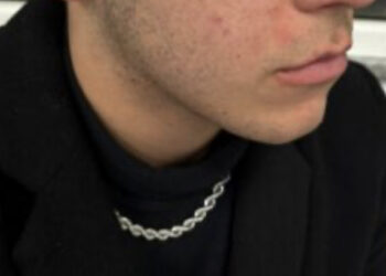 Cagliari, aggressione choc fuori dalla mensa di via Premuda: in sette picchiano selvaggiamente due ragazzi, “ho un trauma cranico”