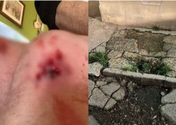 Assemini, ginocchia insanguinate dopo la scivolata sul marciapiede