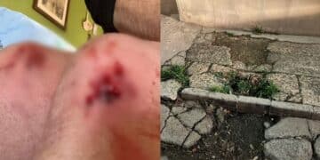 Assemini, ginocchia insanguinate dopo la scivolata sul marciapiede