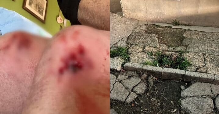 Assemini, ginocchia insanguinate dopo la scivolata sul marciapiede