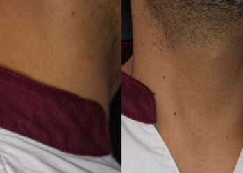 Brotzu, ai coordinatori non è concesso il tempo per indossare la divisa: “Demotivati professionalmente e sconfortati psicologicamente”