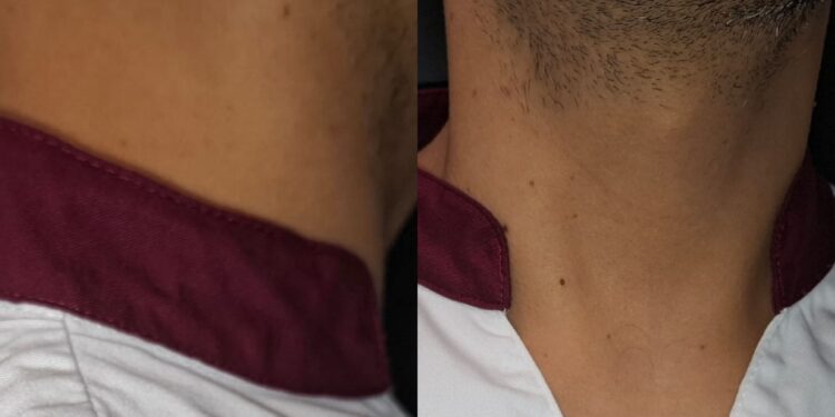 Brotzu, ai coordinatori non è concesso il tempo per indossare la divisa: “Demotivati professionalmente e sconfortati psicologicamente”