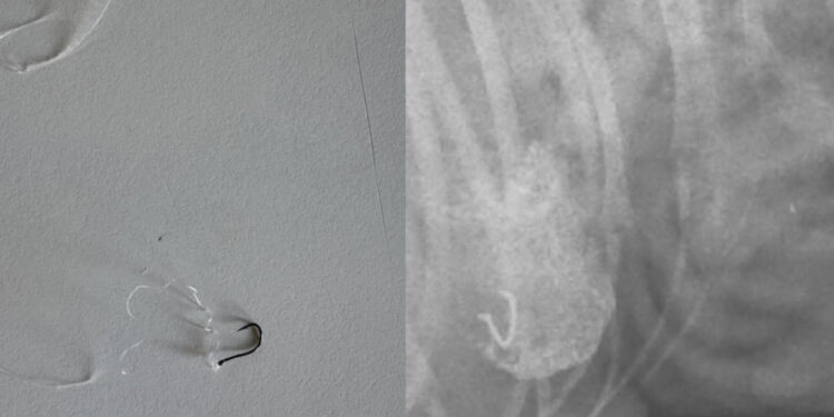 Ami in spiaggia si possono trasformare in pericoli per animali e persone: ultimi casi nelle coste del Sud Sardegna