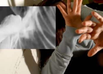 Cagliari, violenza choc al femminile: in un video schiaffi, pugni e capelli strappati per gelosia