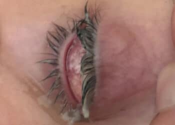 Cagliari, grave infezione all’occhio e nessuna assistenza nel weekend: “Salvata da dottor Cau”