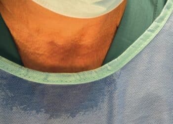 Cagliari, temperature record in sala operatoria. Chirurgia in tilt, disagi per le urgenze: “Fuori da ogni linea guida”