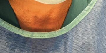 Cagliari, temperature record in sala operatoria. Chirurgia in tilt, disagi per le urgenze: “Fuori da ogni linea guida”