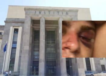 Pestaggio di Ferragosto a Plagemesu, Emanuele Bachis finì sfigurato: assolti e prosciolti i sei giovani imputati dopo due anni di processo