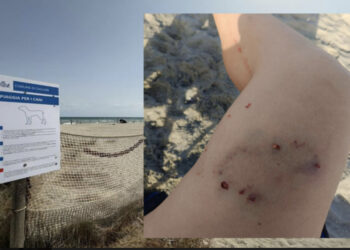 Cagliari, aggredita da un cane al Poetto: 49enne ferita alla coscia