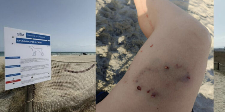 Cagliari, aggredita da un cane al Poetto: 49enne ferita alla coscia