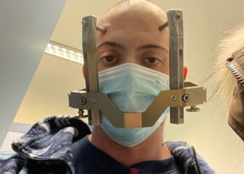 “Ho vinto la mia battaglia grazie al Gamma Knife”: il racconto di Manuel Meniconi emoziona la Sardegna