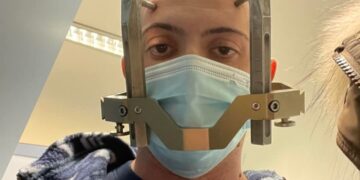 “Ho vinto la mia battaglia grazie al Gamma Knife”: il racconto di Manuel Meniconi emoziona la Sardegna