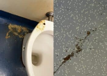 Cagliari, nel bagno del Pronto Soccorso del Brotzu anche vomito e formiche