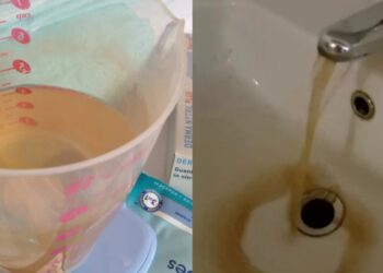 Policlinico, NurSind denuncia: “Acqua color ruggine e maleodorante da un mese”